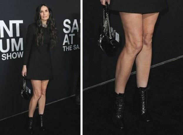 Na fotografii Demi Moore. Myslíte si, že jej nohy vyzerajú zle? I - nie!